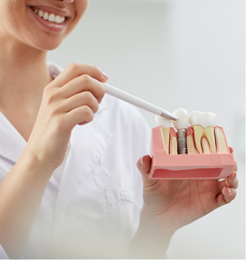 Dental Implants