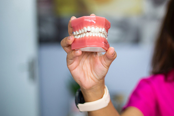 Dentures – Boronia And Bayswater
