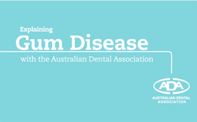 Explaining Gum Disease