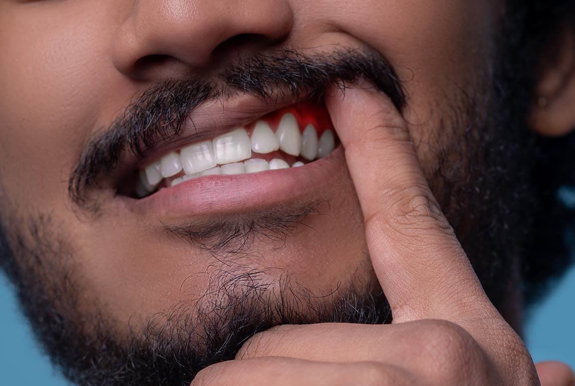 Periodontal / Gum Disease Treatment