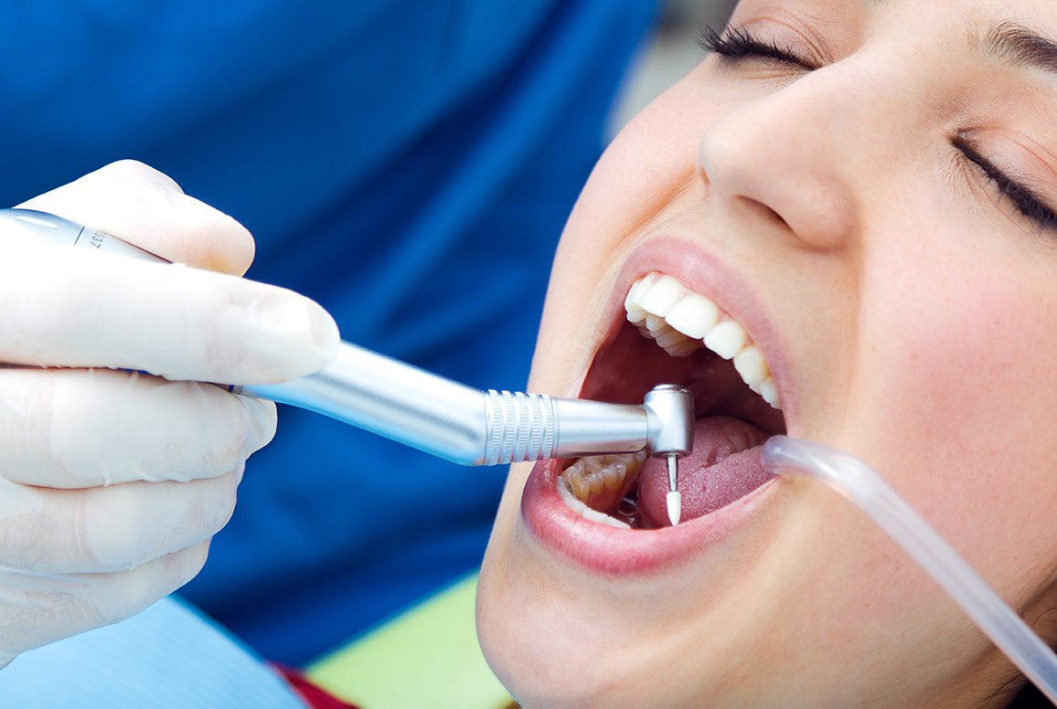 Root Canal Treatment