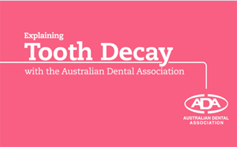 Explaining tooth decay