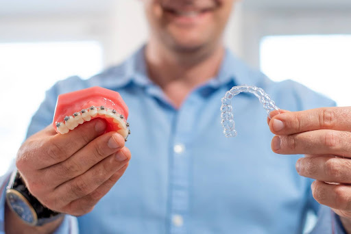dentist showing braces on teeth mould and clear aligners 